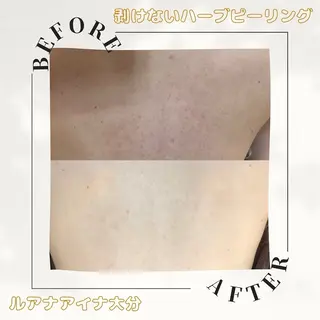 ルアナアイナ 大分のエステ・リラクイメージ