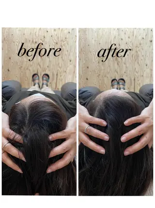 ate'所属・個室ドライヘッドスパ 🍃moriのエステ・リラクイメージ