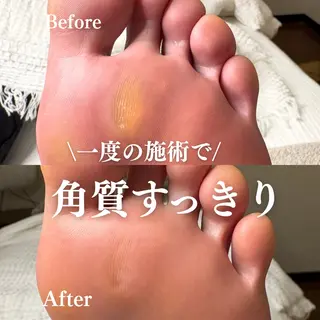 Foot Care Salon Coco 拝島店所属・Foot Salon -Coco-拝島店のエステ・リラクイメージ