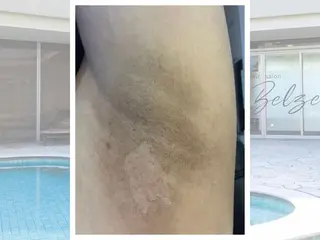 実村💚BLEZE 毛穴/脱毛/痩身のエステ・リラクイメージ