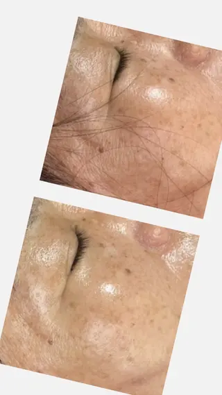 脱毛和みサロン新茶屋所属・脱毛和みサロン新茶屋 ひろみ（女性専用）のエステ・リラクイメージ