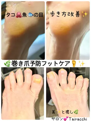 ネイル Tairacchi ﾀｲﾗｯﾁのエステ・リラクイメージ