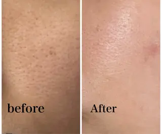 ROR Akariのエステ・リラクイメージ