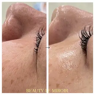 ビューティー ミロワールのエステ・リラクイメージ