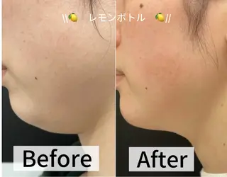 LUMINAESTH所属・LUMINA ESTHのエステ・リラクイメージ