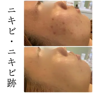 ハーブピーリング専門 BIOEL横浜のエステ・リラクイメージ