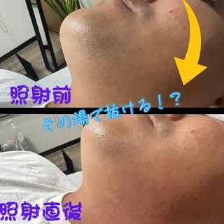 メンズ キッズ メンズ脱毛　FELISSE【フェリッセ】所属・メンズ脱毛フェリッセ /男女🆗キッズ🆗のエステ・リラクイメージ