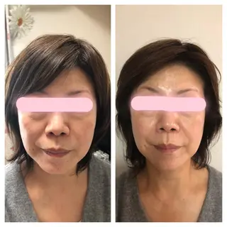 HARIKA鍼灸所属・HARIKA 鍼灸のその他イメージ