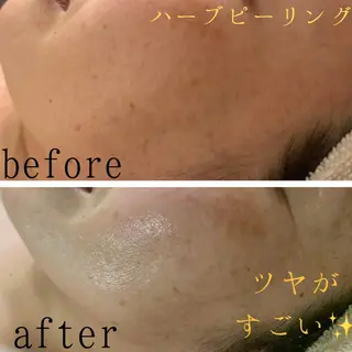 エステfreep takamoriのエステ・リラクイメージ