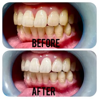 two nailのネイルデザイン