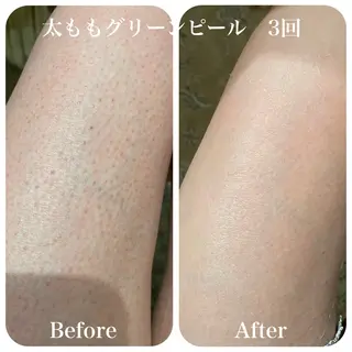 グリーンピール専門店 サロンY【大阪】のエステ・リラクイメージ