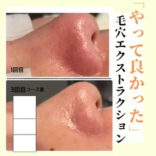 ピーリング専門店 Belluteのエステ・リラクイメージ