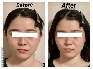 小顔矯正Sho  FaceDesignのエステ・リラクイメージ