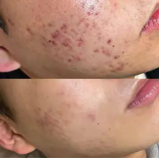 マツエク・マツパ 愛維美水光美肌専門店所属・愛維美水光美肌専門店 メンズレディースokのエステ・リラクイメージ