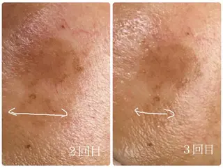 エル美容室所属・oshima yuukiのマツエク・マツパデザイン