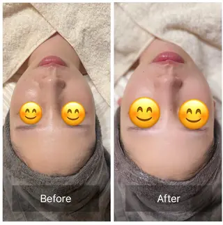 フェイシャルサロン ultimateのエステ・リラクイメージ