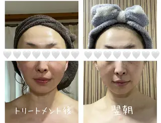 糸島 エステサロンmiuのエステ・リラクイメージ