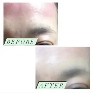 ハーブピーリング・毛穴ケア専門サロンSalon de LENA所属・ハーブピーリング 専門店/名古屋駅前店のその他イメージ