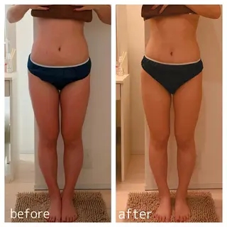 脱毛・痩身強化サロン リアンメルシー佐々木のエステ・リラクイメージ