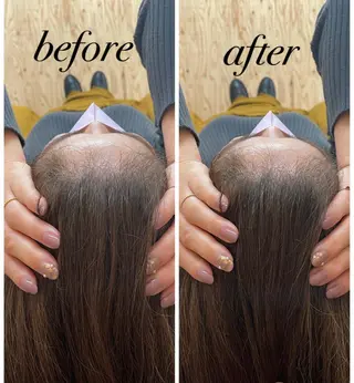 ate'所属・個室ドライヘッドスパ 🍃moriのエステ・リラクイメージ