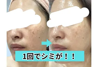 エステ♡Eden HINAKOのエステ・リラクイメージ