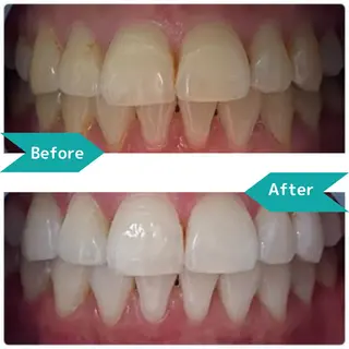 Twinkle White上尾店のエステ・リラクイメージ