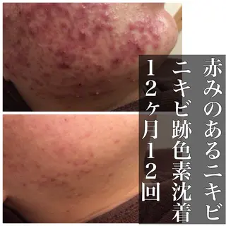 ミディアム カラー パーマ ヘアアレンジ メンズ キッズ ネイル マツエク・マツパ ニキビ・肌質改善専門 ♡人生が変わるサロンのエステ・リラクイメージ