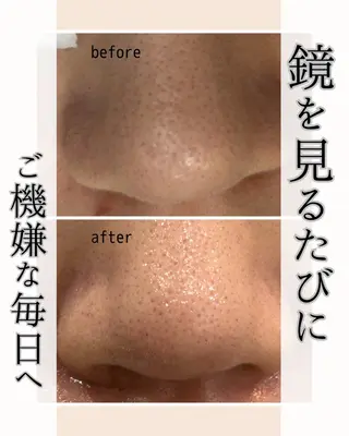 小顔・毛穴・たるみ ネイル　似内真樹のエステ・リラクイメージ