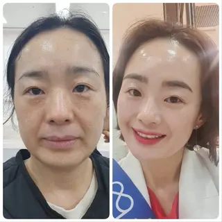 小顔/たるみ/黒ずみ除去専門サロン/SONA 大和西大寺店所属・【小顔専門看護師 サロンSONA】のエステ・リラクイメージ