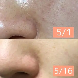 ROR所属・ROR nailのエステ・リラクイメージ