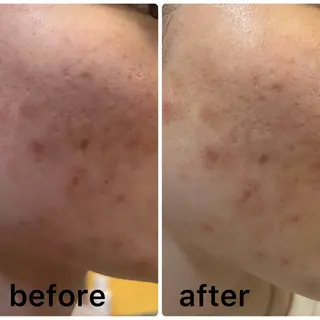 メナードフェイシャルサロン　リンガーデン所属・田中 友佳理のエステ・リラクイメージ