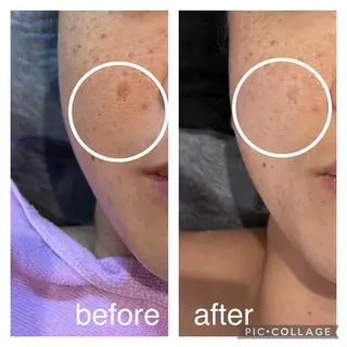 🅖🅤🅩🅔🅛 salonのエステ・リラクイメージ