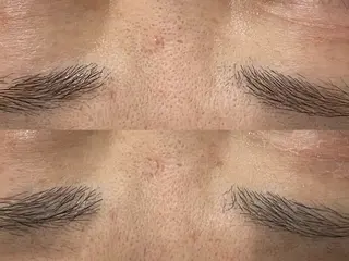 private salon éclat所属・ニキビ・毛穴専門 éclat/エクラのエステ・リラクイメージ