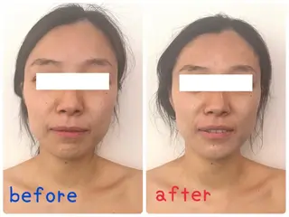 ニキビ・ニキビ跡専門 Solaのエステ・リラクイメージ