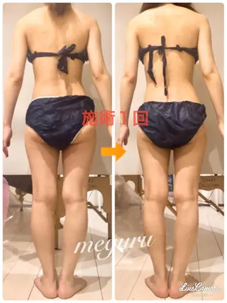 ショート カラー パーマ ヘアアレンジ メンズ キッズ ネイル マツエク・マツパ ‍痩身＆ボディ 結果出し🌟丹野のエステ・リラクイメージ