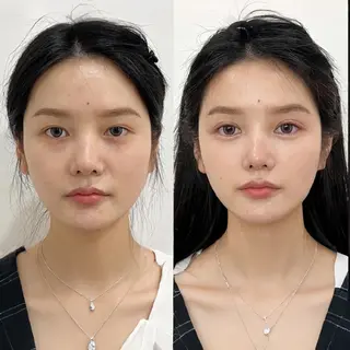 aliaハイフ&水光ジェットサロン所属・aliaハーブ水光店 エステティシャン募集のエステ・リラクイメージ