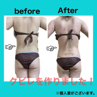 痩身/脱毛/ネイル HARUKAのエステ・リラクイメージ