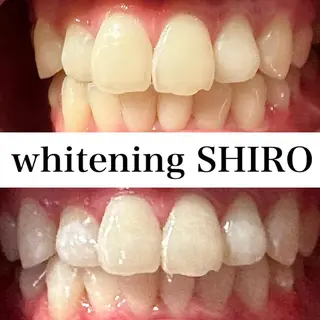 福岡ホワイトニング SHIRO天神店のエステ・リラクイメージ