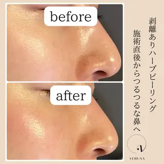 ピーリング専門店 Belluteのエステ・リラクイメージ