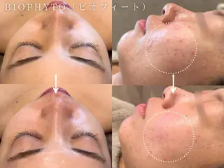 癒し&美活サロン COALALU麻布のエステ・リラクイメージ