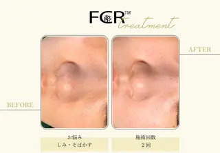 ララピール銀座 小顔フェイシャルのエステ・リラクイメージ