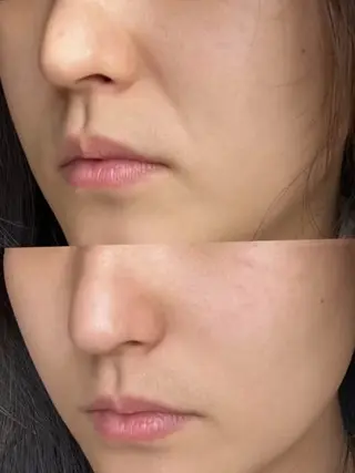 aliaハイフ&水光ジェットサロン所属・aliaハーブ水光店 エステティシャン募集のエステ・リラクイメージ