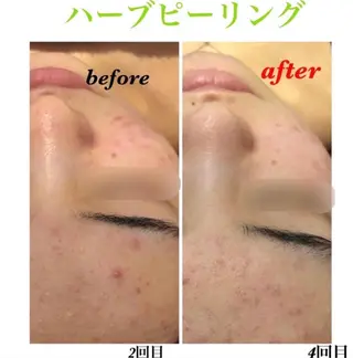 The Esthe .赤坂店のエステ・リラクイメージ