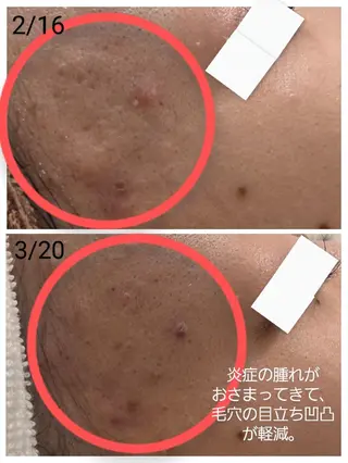 上尾Luce. あきやまのエステ・リラクイメージ