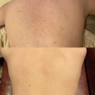 Remina clinical salon所属・ハイフ美肌専門 Remina.c.sのエステ・リラクイメージ