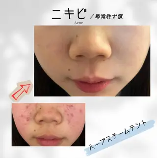 ハーブ蒸しサロン🌿 香嬉琉🌿きよかのエステ・リラクイメージ