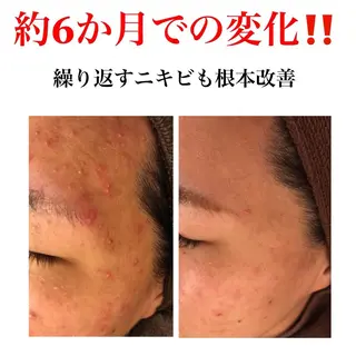 ミディアム カラー パーマ ヘアアレンジ メンズ キッズ ネイル マツエク・マツパ ニキビ・肌質改善専門 ♡人生が変わるサロンのエステ・リラクイメージ