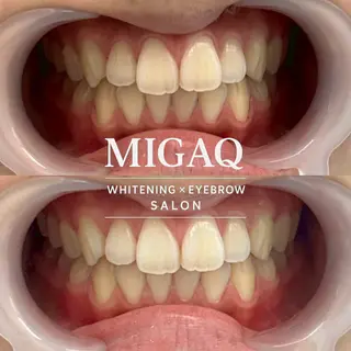 歯のホワイトニング専門店 MIGAQ 京都四条大宮店所属・佐藤 未来の眉毛・アイブロウイメージ