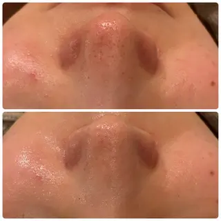 yellow.所属・yellow💛【 脱毛&フェイシャル】のエステ・リラクイメージ