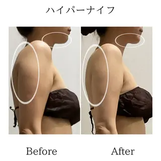 LiLL by Andre beauty所属・LiLL 熊本のエステ・リラクイメージ